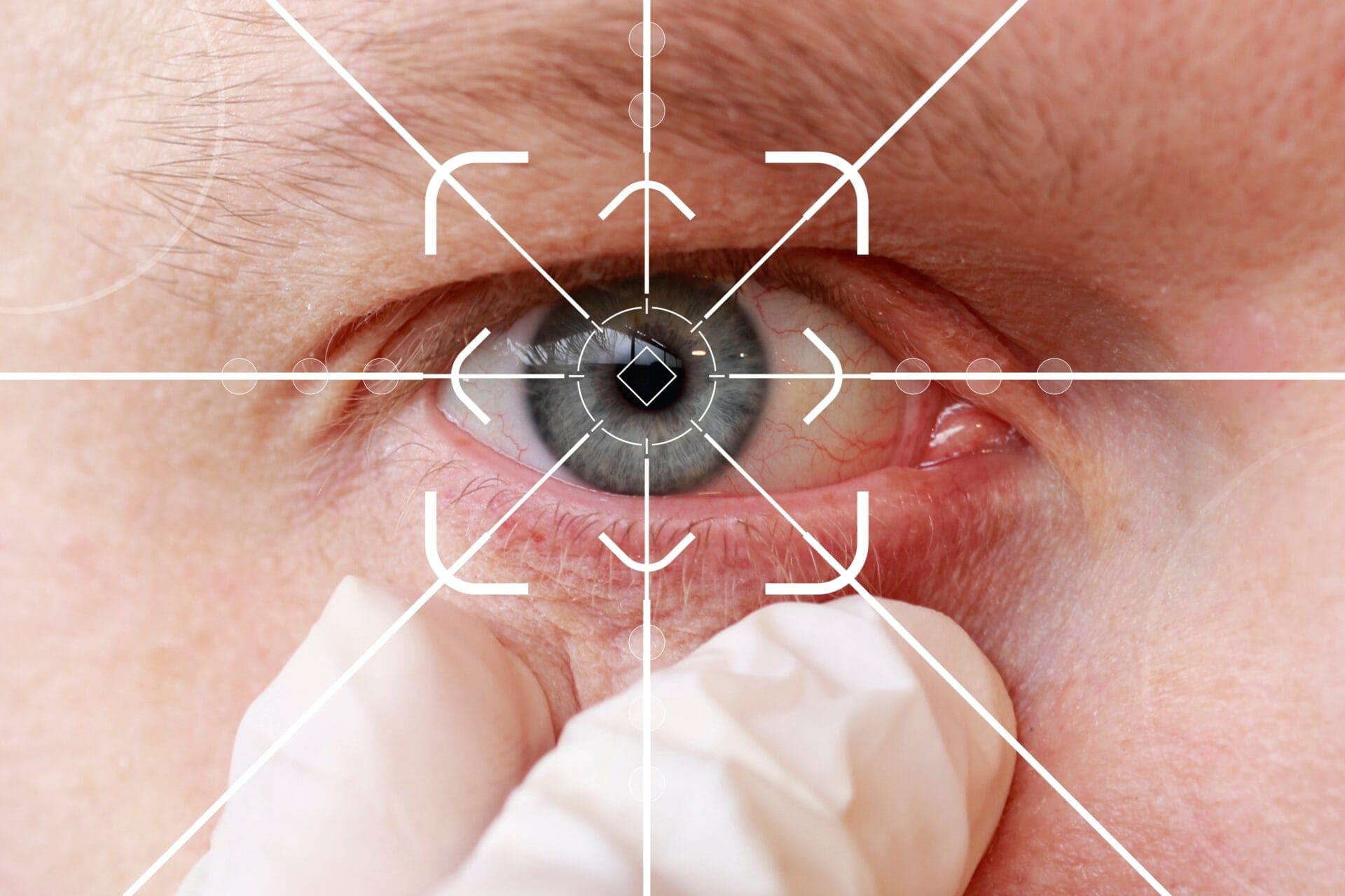 eye tracking